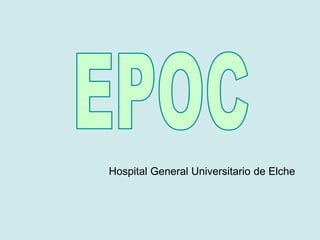 Hospital General Universitario de Elche
 