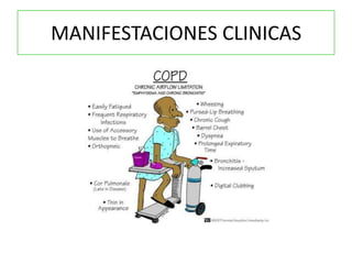 MANIFESTACIONES CLINICAS
 