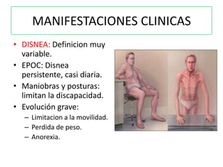 MANIFESTACIONES CLINICAS
• DISNEA: Definicion muy
  variable.
• EPOC: Disnea
  persistente, casi diaria.
• Maniobras y posturas:
  limitan la discapacidad.
• Evolución grave:
   – Limitacion a la movilidad.
   – Perdida de peso.
   – Anorexia.
 