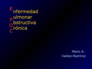 E
P
O
C
Mario A.
Valdez-Ramírez
nfermedad
ulmonar
bstructiva
rónica
 