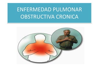ENFERMEDAD PULMONAR
OBSTRUCTIVA CRONICA
 