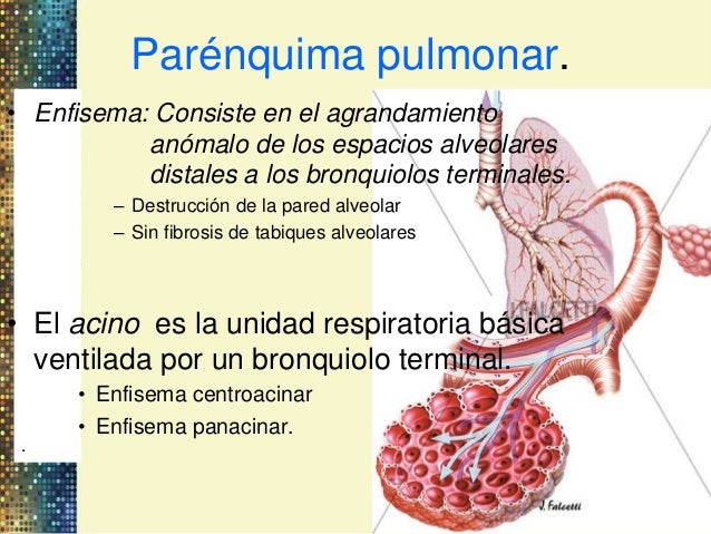 epoc