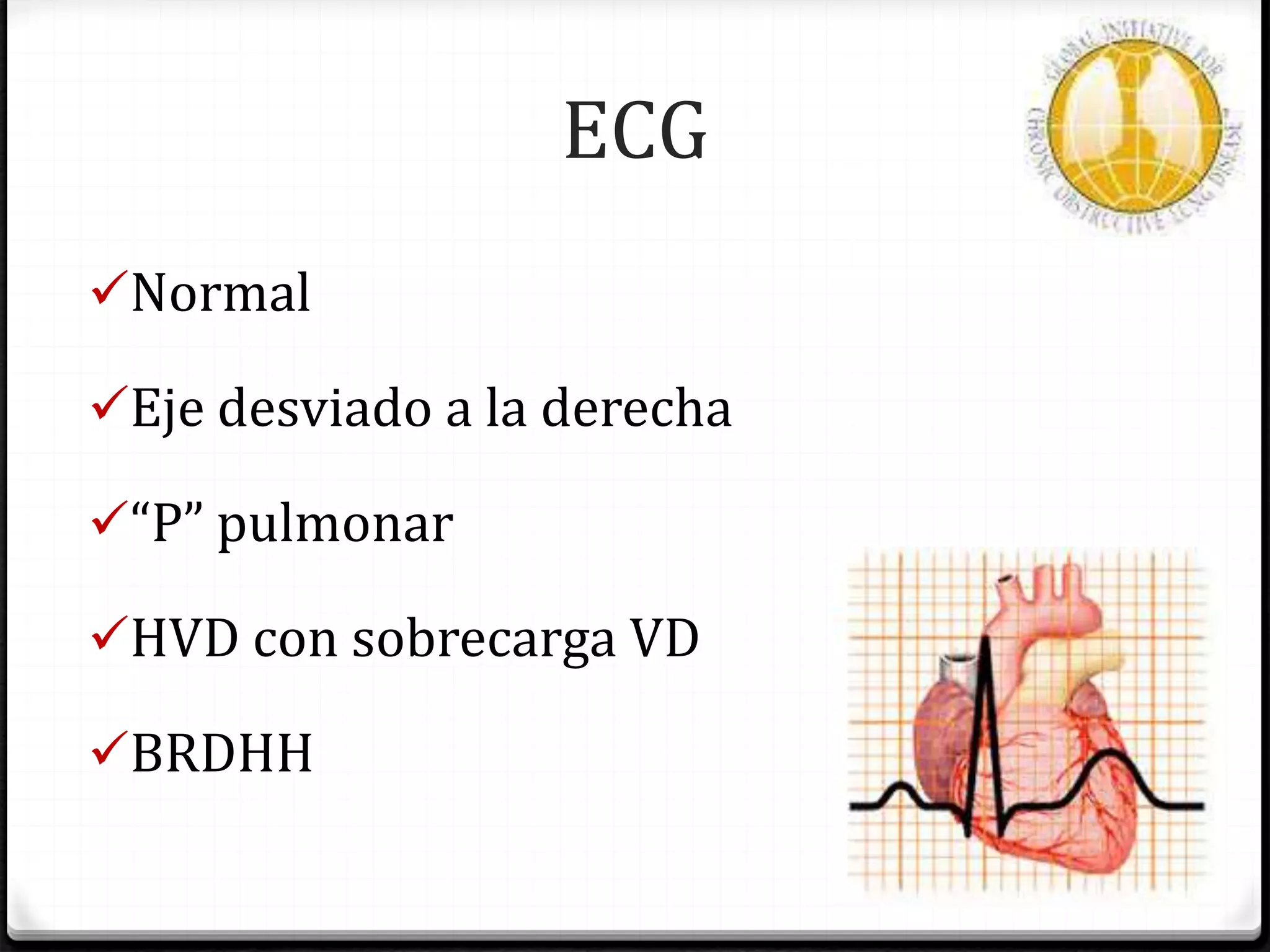 ECG
Normal
Eje desviado a la derecha
“P” pulmonar
HVD con sobrecarga VD
BRDHH
 