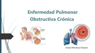 Enfermedad Pulmonar
Obstructiva Crónica
Grezia Mendoza Chipana
 