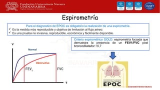 Espirometría
Criterio espirométrico GOLD: espirometría forzada que
demuestra la presencia de un FEV1/FVC post
broncodilatador <0,7
Para el diagnostico de EPOC es obligatorio la realización de una espirometría.
 Es la medida más reproducible y objetiva de limitación al flujo aéreo.
 Es una prueba no invasiva, reproducible, económica y fácilmente disponible.
 