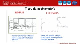 Tipos de espirometría
 