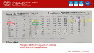200ML
12%
70%
30%
Alteración obstructiva severa sin cambios
significativos al broncodilatador.
 
