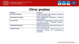 Otras pruebas
 