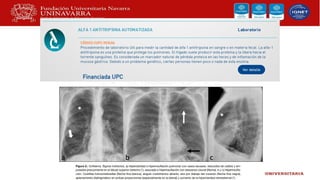 Enfermedad pulmonar obstructiva cronica.pptx