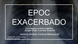 EPOC
EXACERBADO
Jorge Elias Correa Guerra
Jeremy Andres Corena Blanquicet
V SEMESTRE- SEMIOLOGIA
CARDIOPULMONAR
 
