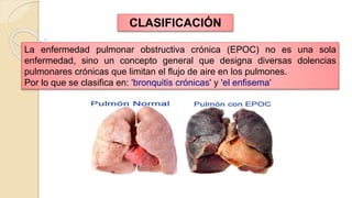 La enfermedad pulmonar obstructiva crónica (EPOC) no es una sola
enfermedad, sino un concepto general que designa diversas dolencias
pulmonares crónicas que limitan el flujo de aire en los pulmones.
Por lo que se clasifica en: 'bronquitis crónicas' y 'el enfisema'
CLASIFICACIÓN
 