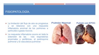 FISIOPATOLOGÍA.
 La limitación del flujo de aire es progresiva
y se relaciona con una respuesta
inflamatoria anormal de los pulmones a
partículas o gases nocivos.
 La respuesta inflamatoria ocurre en toda la
extensión de las vías respiratorias
proximales y periféricas, el parénquima
pulmonar y la vasculatura pulmonar.
 