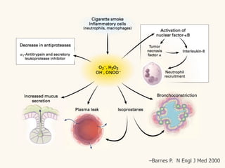 –Barnes P. N Engl J Med 2000
 