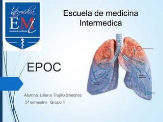 EPOC
Alumna: Liliana Trujillo Sánchez
5ª semestre Grupo 1
Escuela de medicina
Intermedica
 