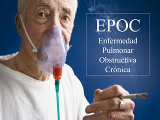 EPOC
Enfermedad
Pulmonar
Obstructiva
Crónica
 