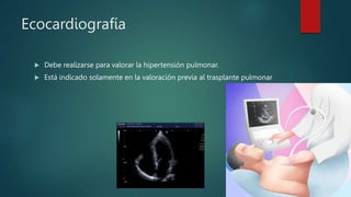 Ecocardiografía
 Debe realizarse para valorar la hipertensión pulmonar.
 Está indicado solamente en la valoración previa al trasplante pulmonar
 