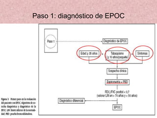 Paso 1: diagnóstico de EPOC
 