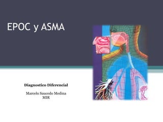 EPOC y ASMA
Diagnostico Diferencial
Marcelo Saucedo Medina
MIR
 