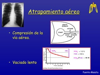 Atrapamiento aéreoAtrapamiento aéreo
• Compresión de laCompresión de la
vía aérea.vía aérea.
• Vaciado lentoVaciado lento
Puente-Maestu
 