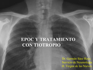 EPOC Y TRATAMIENTO CON TIOTROPIO Dr. Germán Sáez Roca Servicio de Neumología H. Virgen de las Nieves 