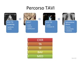 Percorso TAVI




                32 di 22
 