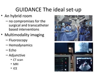 GUIDANCE The ideal set-up
• An hybrid room
  – no compromises for the
    surgical and transcatheter
    based interventions
• Multimodality imaging
  – Fluoroscopy
  – Hemodynamics
  – Echo
  – Adjunctive
     • CT scan
     • MRI
     • ICE
 