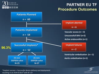 PARTNER EU TF
                                                               Procedure Outcomes
                  Patients Planned
                         n = 60
                                                                   Implant aborted
                                                                         n=6
                Patients Implanted
                                                                  Vascular access (n = 3)
                         n = 54                                   Unsucessfull BAV (n=2)
                                                                  Active endocarditis (n=1)

               Successful Implants*                                Implant failures
96.3%                                                                    n=2
                         n = 52
                                                                 Ventricular embolization (n = 1)
             23 mm                   26 mm                       Aortic embolization (n=1)
           SAPIEN valve            SAPIEN valve
              N=25                    N=27


*Implant success = Successful device delivery and deployment
resulting in an AVA>0.9cm² with AI <2+
 