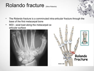 eponymousfractures-160228213145.pdf