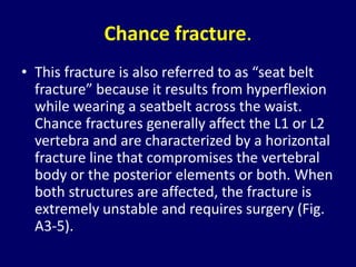 Chance Fracture Seat Belt