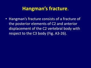 Hangman – Proximal