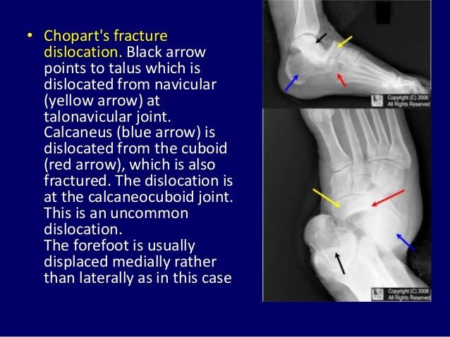 Eponymous fractures name Dr. muhammad Bin Zulfiqar