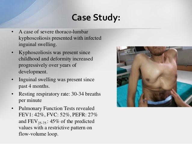 Tap block thesis 03 picture