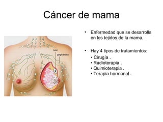 Cáncer de mama Enfermedad que se desarrolla en los tejidos de la mama. Hay 4 tipos de tratamientos: •  Cirugía . • Radioterapia . • Quimioterapia . • Terapia hormonal . 