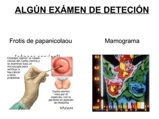 ALGÚN EXÁMEN DE DETECIÓN   Frotis de papanicolaou  Mamograma  (cáncer cervical)  (cáncer de mama) 