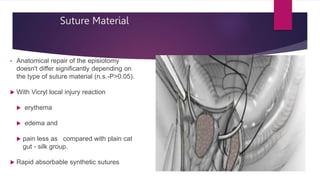 Suture Material
• Anatomical repair of the episiotomy
doesn't differ significantly depending on
the type of suture material (n.s.-P>0.05).
 With Vicryl local injury reaction
 erythema
 edema and
 pain less as compared with plain cat
gut - silk group.
 Rapid absorbable synthetic sutures
 