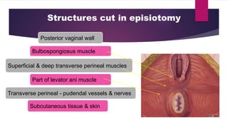 Structures cut in episiotomy
Posterior vaginal wall
Superficial & deep transverse perineal muscles
Bulbospongiosus muscle
Part of levator ani muscle
Transverse perineal - pudendal vessels & nerves
Subcutaneous tissue & skin
 