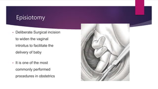 Episiotomy
• Deliberate Surgical incision
to widen the vaginal
introitus to facilitate the
delivery of baby
• It is one of the most
commonly performed
procedures in obstetrics
 