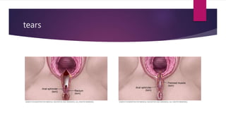 tears
 