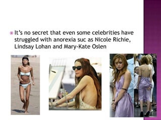  It‟sno secret that even some celebrities have
  struggled with anorexia suc as Nicole Richie,
  Lindsay Lohan and Mary-Kate Oslen
 
