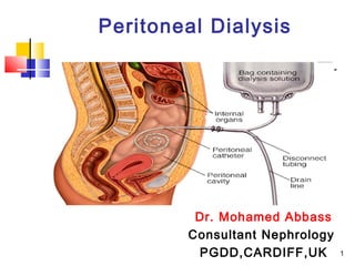 Peritoneal Dialysis
Dr. Mohamed Abbass
Consultant Nephrology
PGDD,CARDIFF,UK 1
 