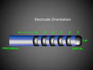 Electrode Orientation
DISTALPROXIMAL
TIP
123456
1 DISTAL
2
3
4
RECORDING
DEVICE
 