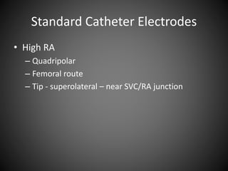Standard Catheter Electrodes
• High RA
– Quadripolar
– Femoral route
– Tip - superolateral – near SVC/RA junction
 