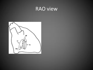 RAO view
 