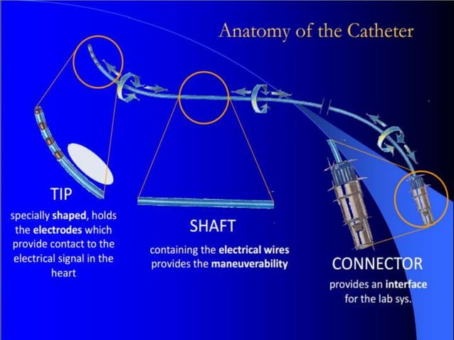 Electrophysiology study basics | PPTX