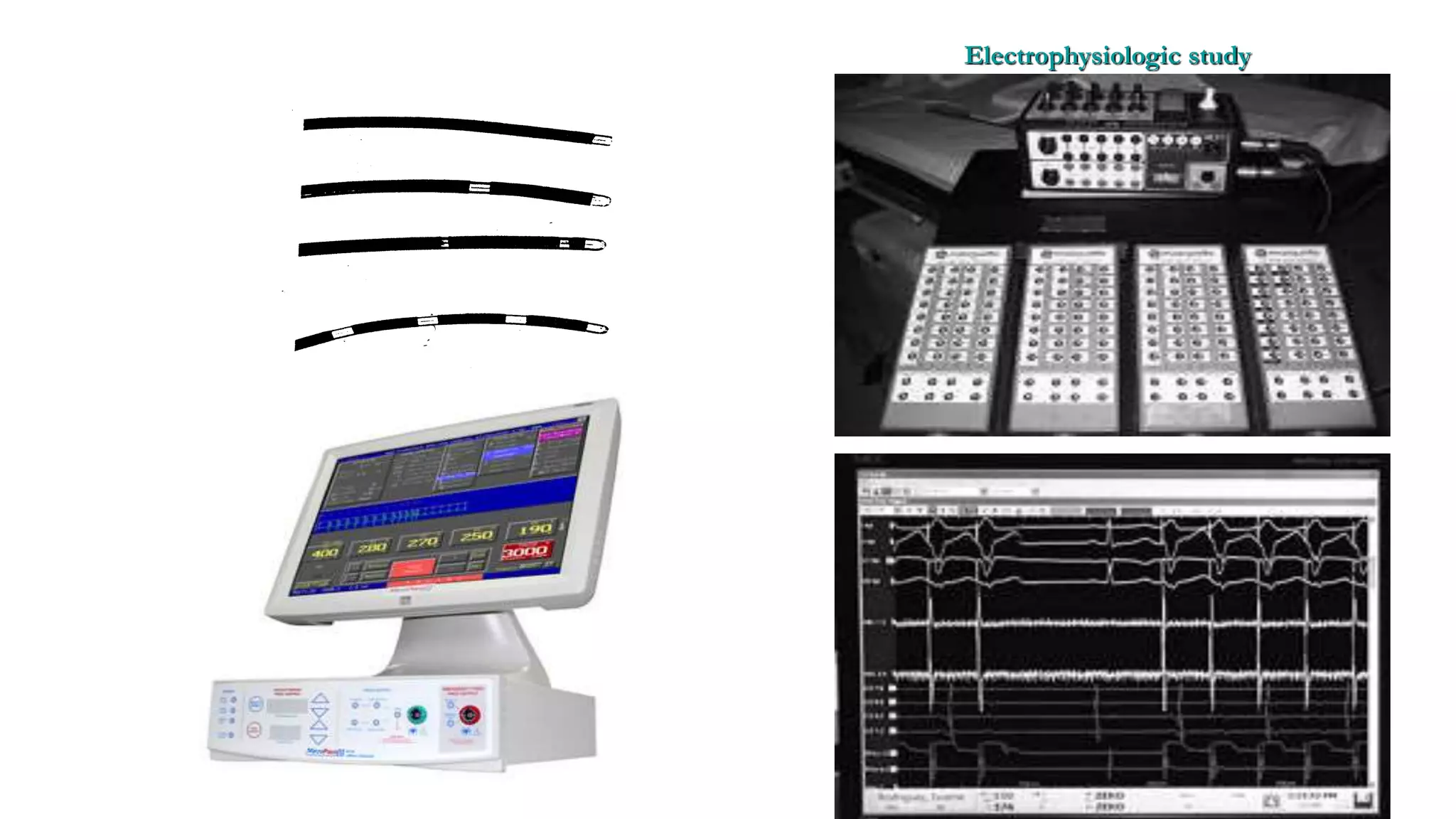 Basics of Electrophysiologic study, part 1 (2020)