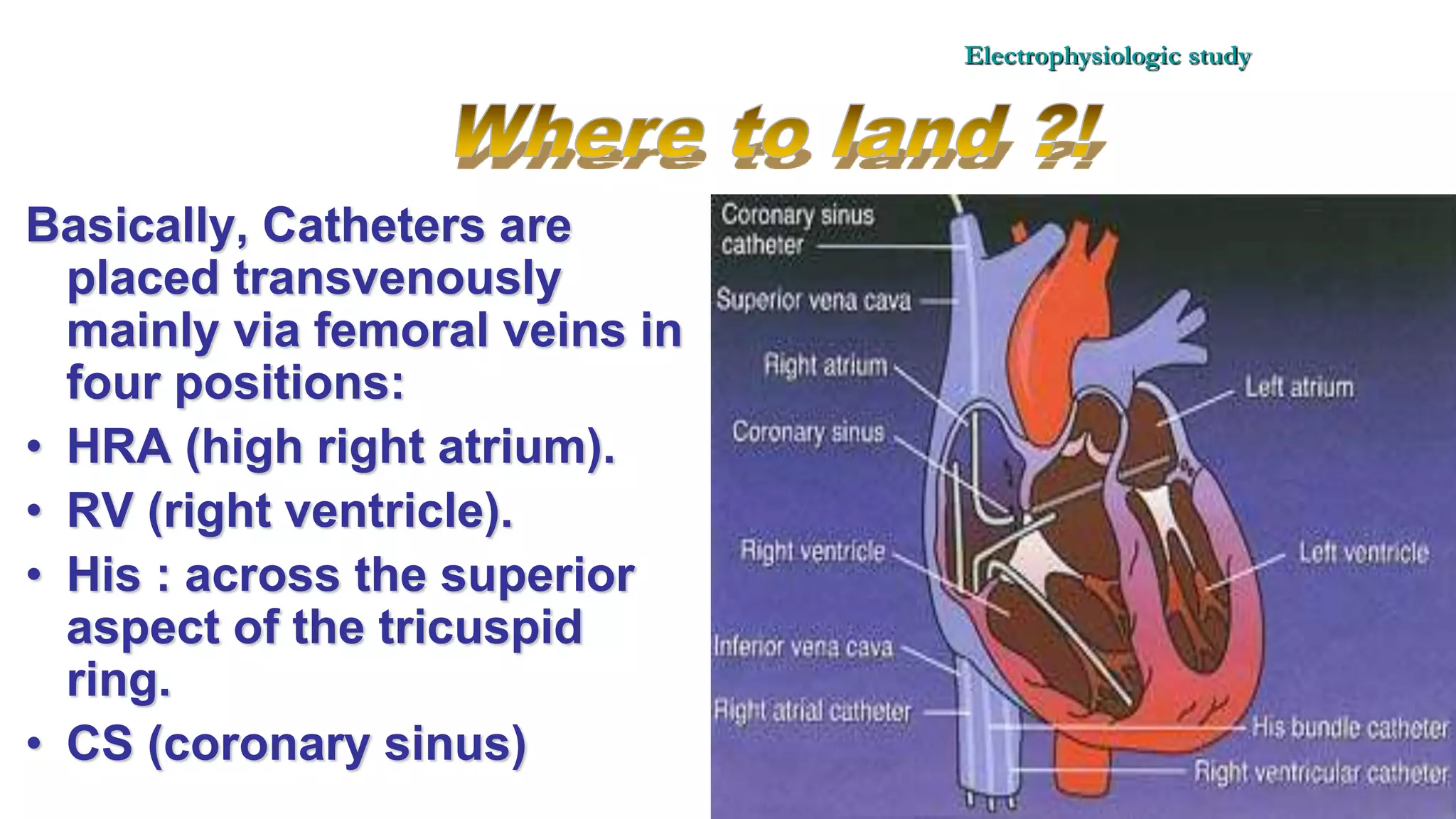 Basics of Electrophysiologic study, part 1 (2020)