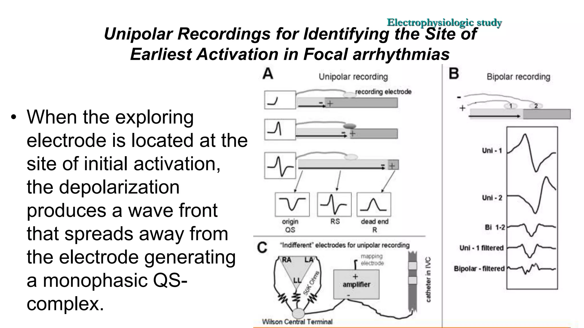 Basics of Electrophysiologic study, part 1 (2020)