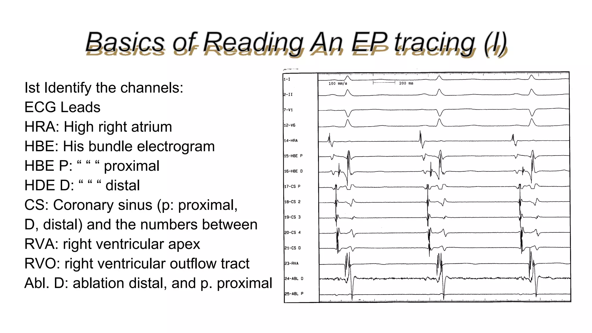 Basics of Electrophysiologic study, part 1 (2020)