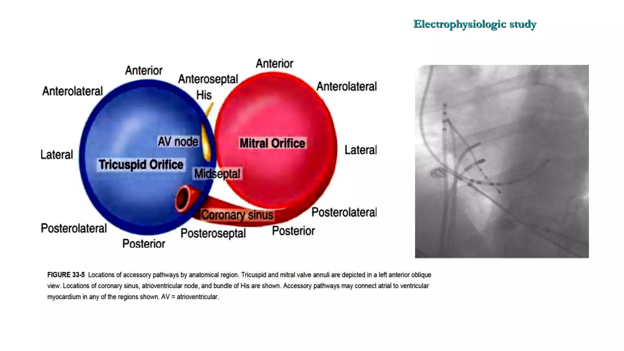 Basics of Electrophysiologic study, part 1 (2020)