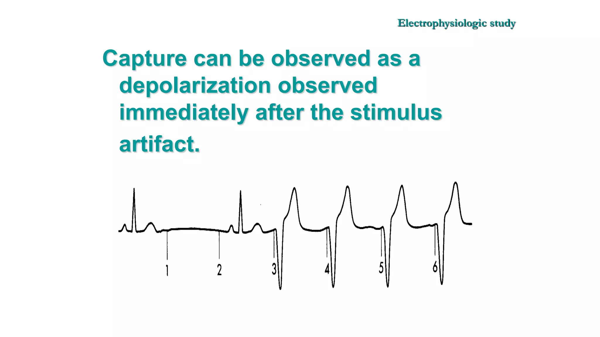Basics of Electrophysiologic study, part 1 (2020)